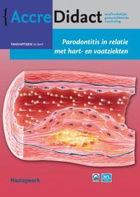 AccreDidact Parodontitis in relatie met hart- en vaatziekten