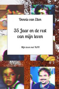 35 jaar en de rest van mijn leven door Dennis van Elten