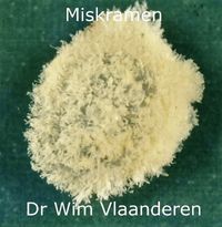 Miskramen door Dr. Wim Vlaanderen